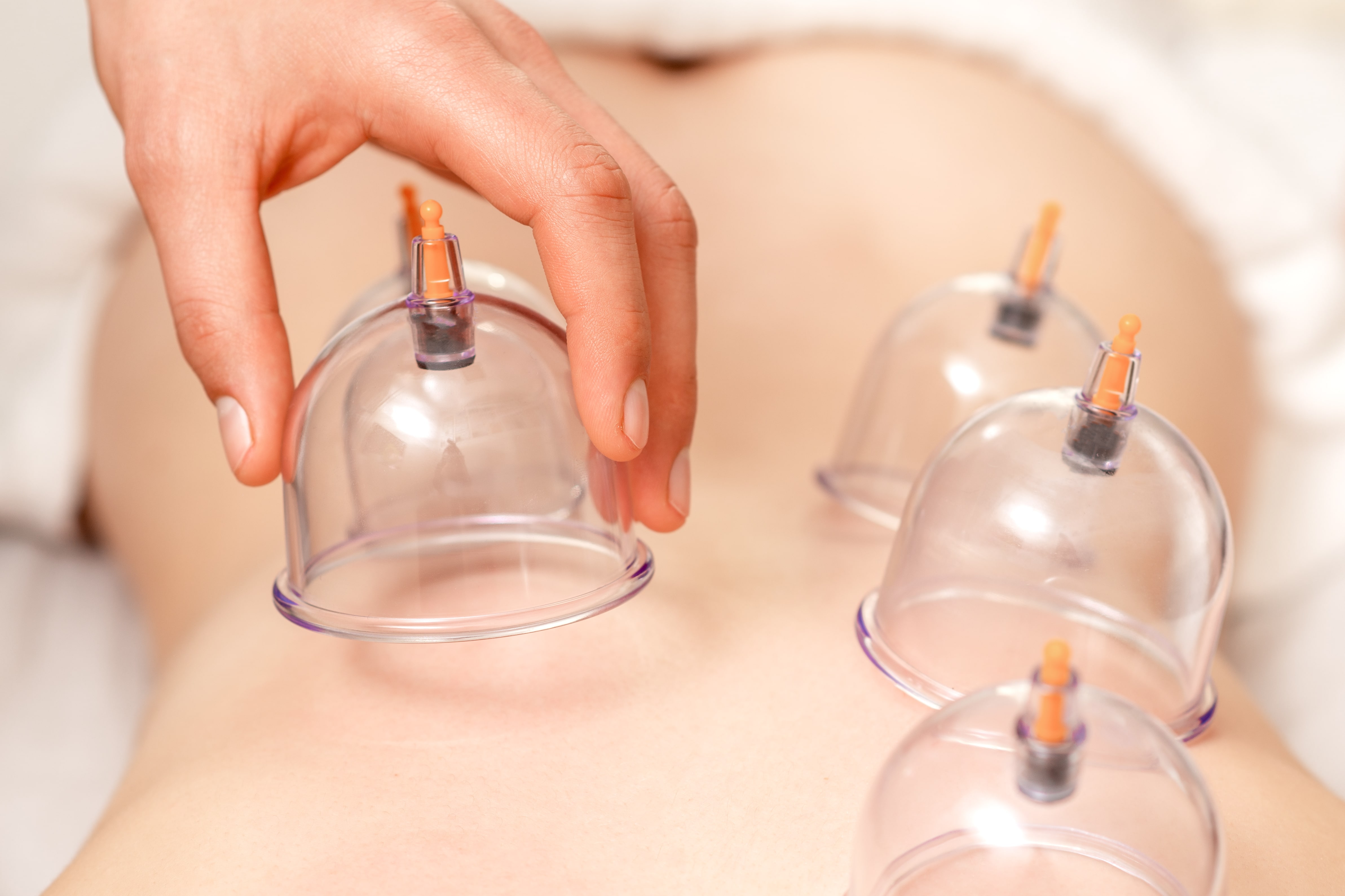 Min Therapeutic Massage Center cupping